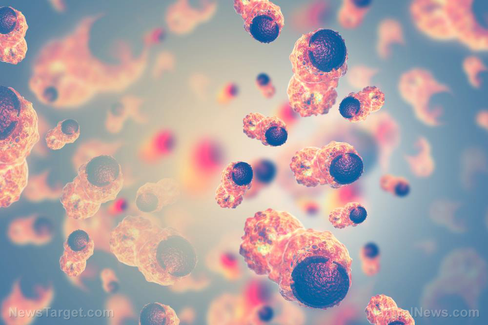 AI-powered medical devices could enhance detection and differentiation of skin cancers – but could also give false readings   – NaturalNews.com