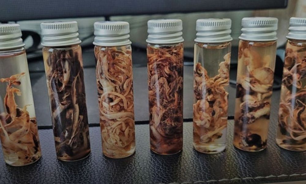 Embalmers are Continuing to Find Mysterious Clots in the Vaccinated – Vigilant News Network