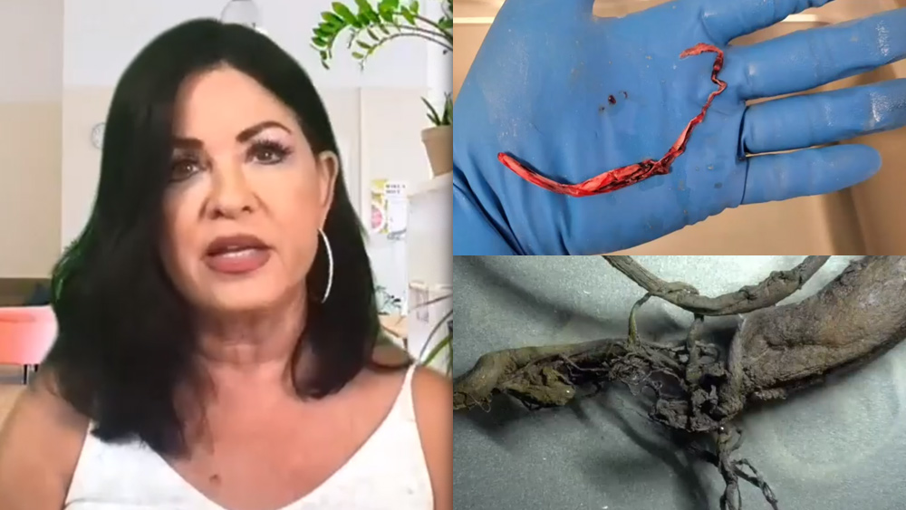 JANE RUBY WAS RIGHT: Hundreds of embalmers are now speaking up about strange, fibrous blood clots in corpses   – NaturalNews.com