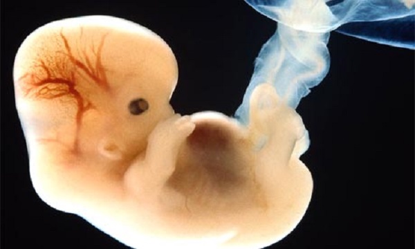 Alabama passes bill that protects IVF service providers from lawsuits following granting of legal personhood to embryos in the state
