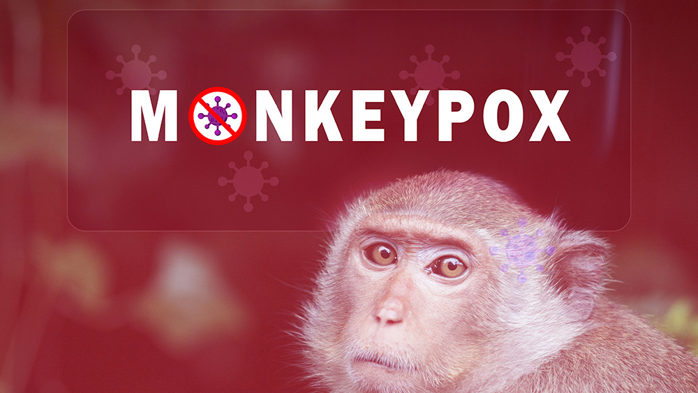 House committee investigation finds Fauci’s NIAID submitted plans to create a mutant monkeypox virus with “pandemic potential” in 2015