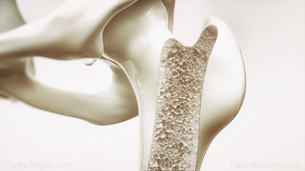 Can intermittent fasting lower your risk of osteoporosis?   – NaturalNews.com