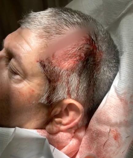 "Anti-White" Attack by Mob at Maui Resort Leaves Six with Serious Injuries | Restoring Liberty