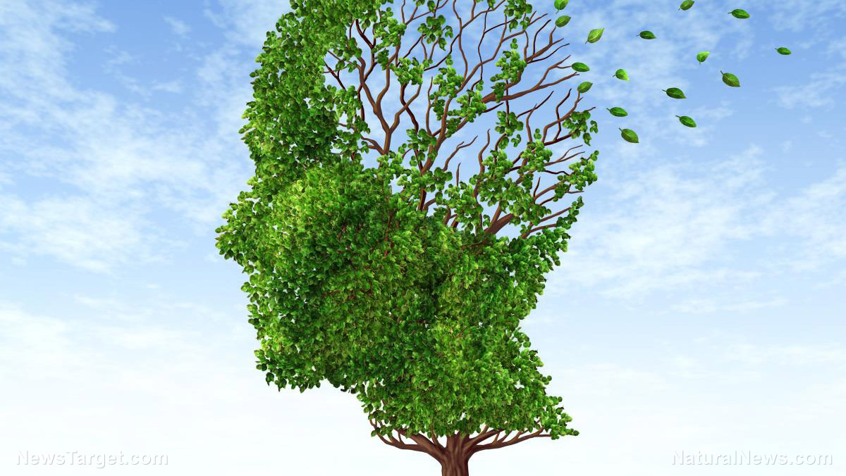 The sweet peril: Post-meal blood sugar spikes linked to higher Alzheimer’s risk