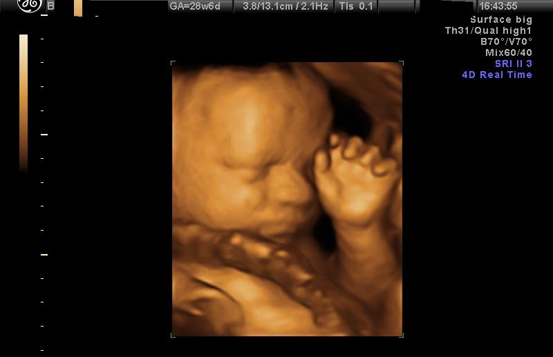 Colombia Considers Constitutional Amendment to Ban Abortions From Conception - LifeNews.com