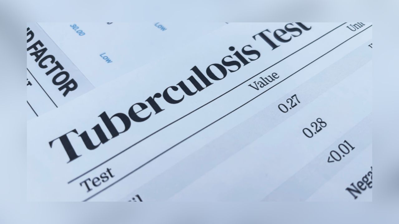 Irving ISD Recommends Tuberculosis Testing After Possible Exposure At MacArthur High