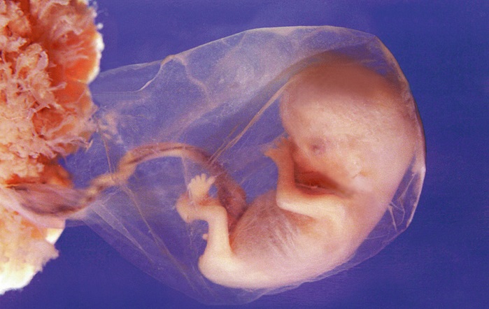 Nebraska Abortions Increase 7.9% as Abortion Pills Kill More Babies - LifeNews.com