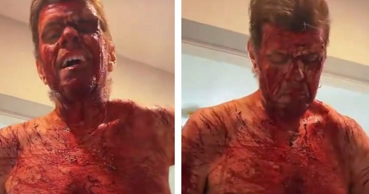 Celebrity Blogger Perez Hilton Still Hospitalized After Cutting Himself on TikTok Live, Will Need Surgery * The Gateway Pundit * by Cristina Laila