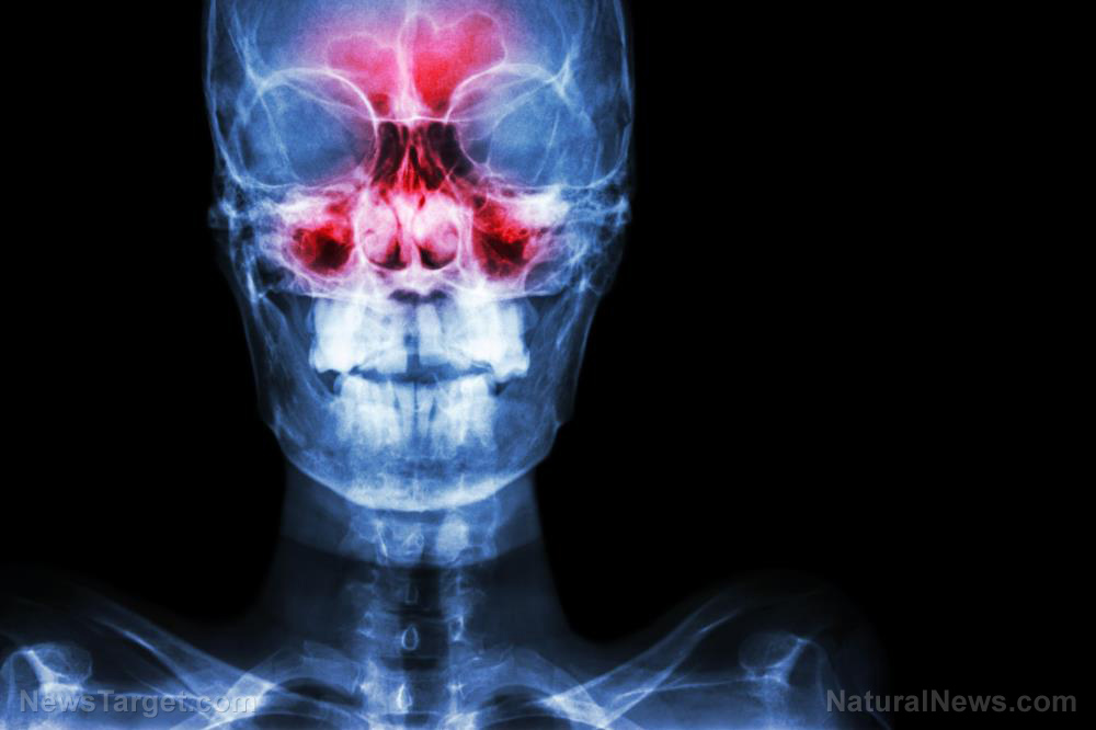 “ATB Personal Restoration Class” on BrightU: Burning away the darkness – the point that claims to consume negative thoughts   – NaturalNews.com