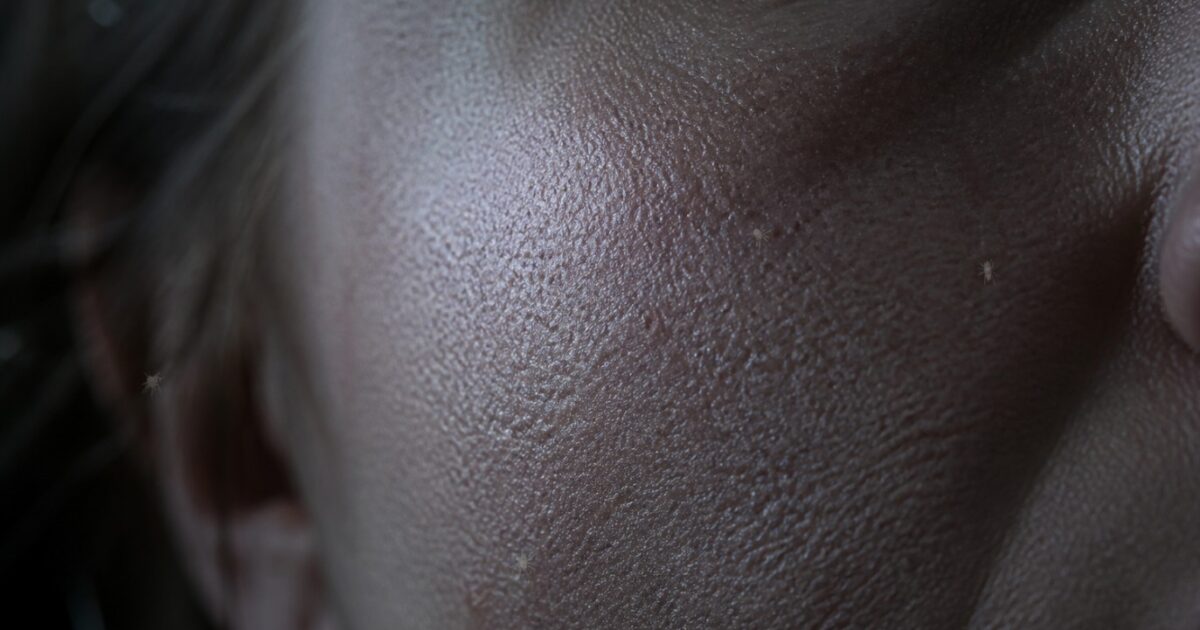 Crazy As It Sounds, There Are Probably Microscopic Mites In Your Face Pores That Come Out At Night * The Gateway Pundit * by Promoted Post