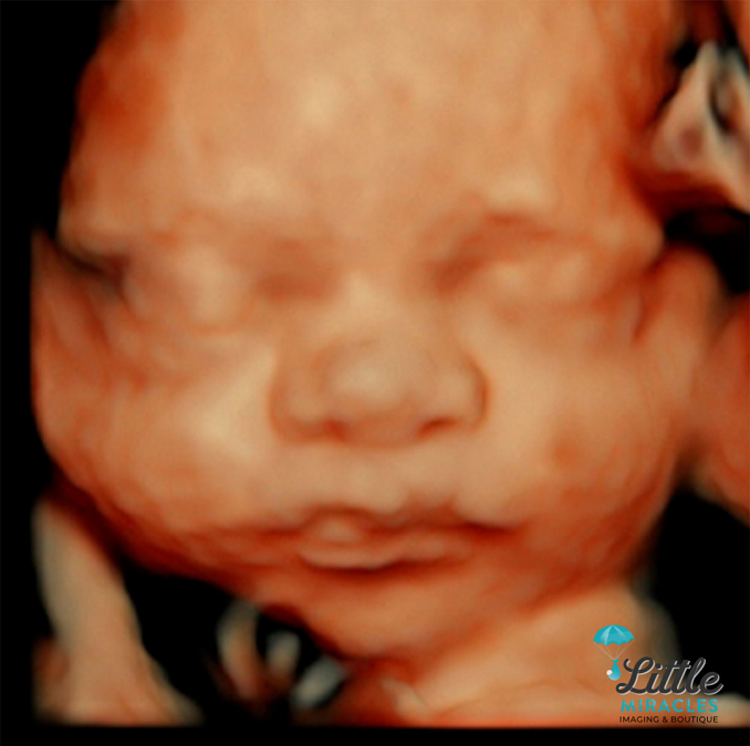 We Can’t Back Down From the Truth: Abortion Kills Babies - LifeNews.com