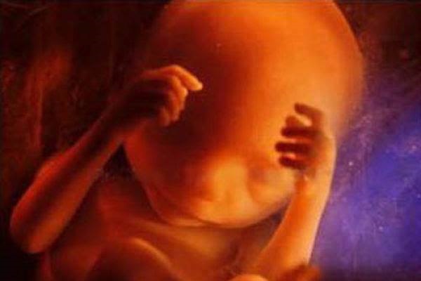 If Republicans Could Make Abortion About Killing Babies, They’d Win the Abortion Debate - LifeNews.com