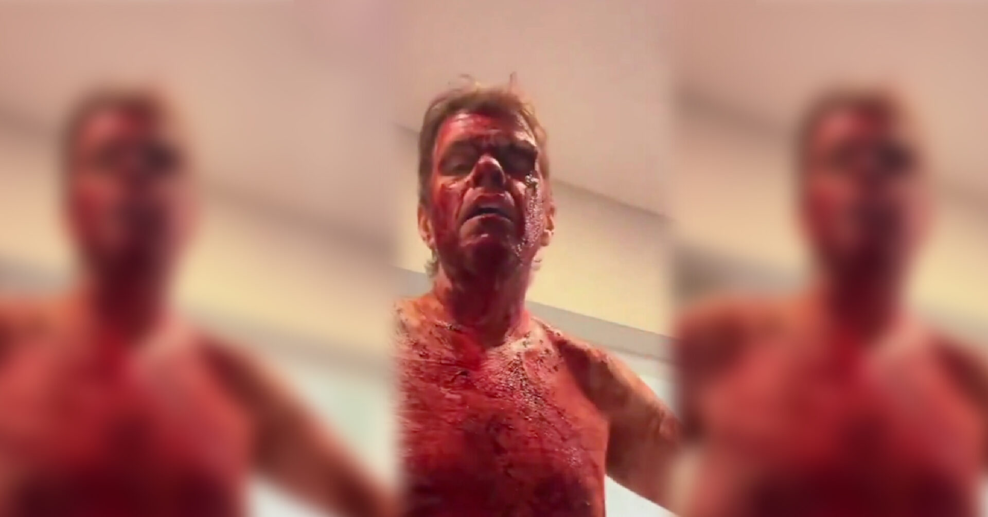 Celebrity blogger Perez Hilton cuts and stabs his body on TikTok Live... - Revolver News