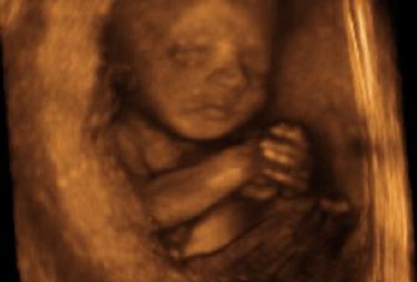 Pro-Life Groups Send Letter Urging DOJ to Stop Mail-Order Abortion Drugs - LifeNews.com
