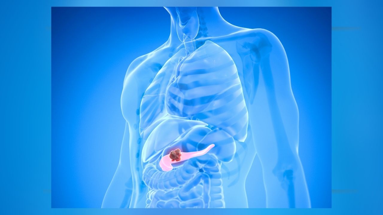 FDA Approves Pill That Nearly Doubled Median Survival In Pancreatic Cancer Trial