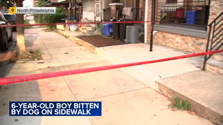 6‑year‑old girl bitten in the face by a dog inside a Kensington home